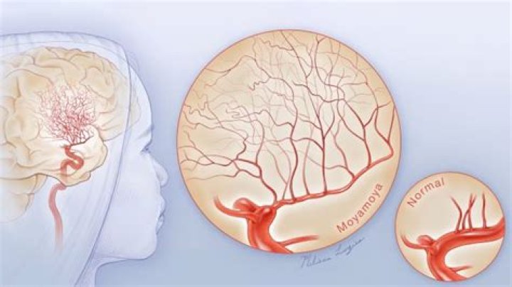 Moya Doherty Illness: What Happened to Moya Doherty?