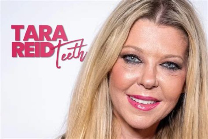 Tara Reid Opens Up About Plastic Surgery : What Happened To Tara Reid? - SarkariResult